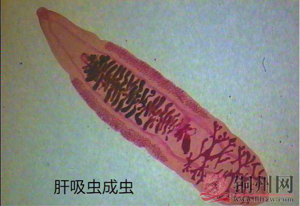 广西500万人感染肝吸虫病,居全国第二!大多是因为吃它!