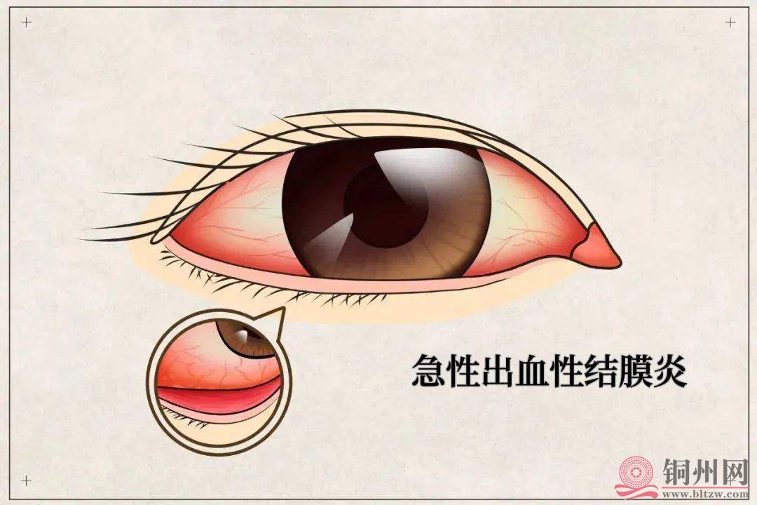 1b814b41935949c880cba91ae99eb7b9.jpg